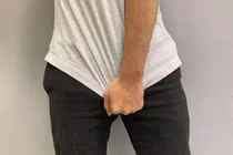 “Cậu nhỏ” quá lớn quá khổ quần, chủ nhân đi khám mới sững sờ