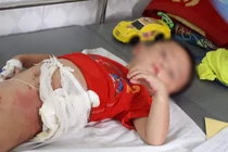 Giành ăn quả dưa chuột, cậu ruột ném cháu trai 4 tuổi vào đống lửa