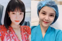 Kỳ Hân thừa nhận: 'Nếu không dao kéo thì tôi xấu tới vô cùng' 