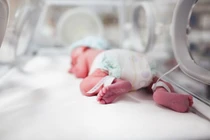 Cụ bà U80 chỉ có một lá phổi hạ sinh bé gái nặng 600 gram