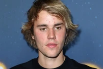 Giữa ồn ào với Taylor SwiftJustin, Bieber xuất hiện mặt đầy mụn 