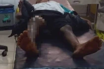 Công an thông tin chính thức vụ bé trai bị đốt