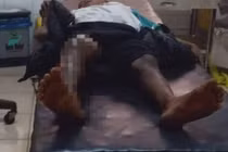 Công an thông tin chính thức vụ bé trai bị đốt