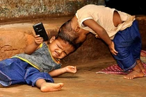 Cặp cha mẹ đợi phép màu cho 2 đứa con dính liền đầu