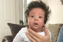 Vừa ra đời, cậu bé gây sốc với mái tóc “có một không hai”