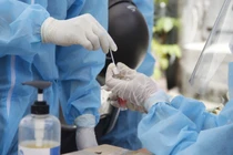 GĐ Sở Y tế Đồng Nai: Không khuất tất khi mua kit test COVID-19 của Việt Á