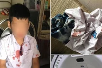 Ông bố đấm bé trai lớp 1 để 'trả thù' thay con: Mẹ nạn nhân lên tiếng