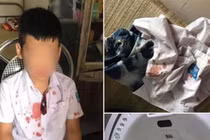 Ông bố đấm bé trai lớp 1 để 'trả thù' thay con: Mẹ nạn nhân lên tiếng