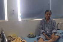 Yêu cầu làm rõ vụ phó chủ tịch phường bị tố đạp gãy chân người dân