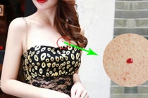 Ai có nốt ruồi son ở 4 vị trí này chỉ việc ung dung hưởng lộc trời 