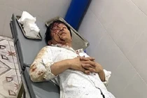 Đi đòi tiền, chủ nợ bị đánh trọng thương