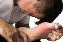 Người bị gút có nên ăn thịt gà? 