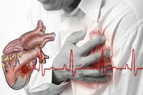 Tác dụng phụ đáng sợ của Aspirin đối với cơ thể 