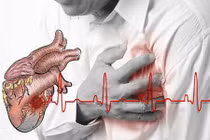 Tác dụng phụ đáng sợ của Aspirin đối với cơ thể 