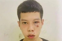 Bắt nam thanh niên cướp giật 16 triệu đồng của cụ bà đi lĩnh lương