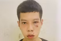 Bắt nam thanh niên cướp giật 16 triệu đồng của cụ bà đi lĩnh lương