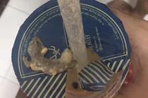 Kinh hoàng vụ khách tố có lẫn thạch sùng trong trà sữa nổi tiếng 