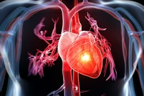 5 loại dầu ăn tốt cho sức khỏe