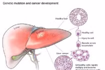 Những biểu hiện của bệnh ung thư gan 