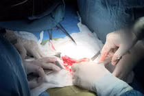 Việt Nam lần đầu tiên ghép thận thành công cho trẻ em từ người chết não