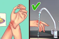 Những mẹo chữa bệnh có thể khiến bạn “lợn lành thành lợn què"