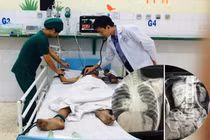 Bé trai vỡ đại tràng, nguy kịch vì bạn bơm hơi vào hậu môn