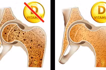 8 dấu hiệu của cơ thể nhắc nhở bạn cần bổ sung ngay vitamin D