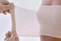 Hoại tử ngực sau hai lần bơm mỡ nhân tạo