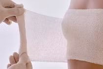 Hoại tử ngực sau hai lần bơm mỡ nhân tạo