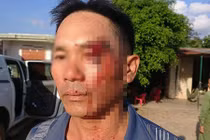 "Tố" cán bộ xã nhận hối lộ, người dân bị đánh đến nhập viện?