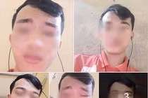 Màn điêu khắc lông mày 'không đỡ nổi' của nam thanh niên