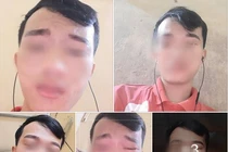 Màn điêu khắc lông mày 'không đỡ nổi' của nam thanh niên
