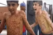 Sát thương kinh hoàng của vũ khí phốt pho Thổ Nhĩ Kỳ 