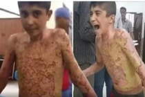 Sát thương kinh hoàng của vũ khí phốt pho Thổ Nhĩ Kỳ 