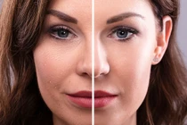 Bài tập yoga giảm béo mặt, xóa mờ nếp nhăn thần kì