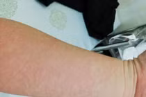 Nhập viện cấp cứu khi phun môi tại Thẩm mỹ viện Ngọc Dung