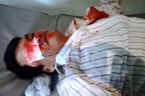 Đa chấn thương, tử vong... sau khi bị công an hỏi cung