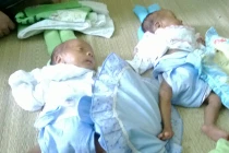 Cặp song sinh suy dinh dưỡng nặng, mẹ bỏ đi, bố không có tiền mua sữa