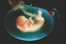 Bí mật sửng sốt về 9 loại nước trong cơ thể người 