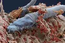 Khám phá loài rận chỉ thích sống trên mặt người