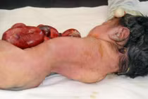 Rùng mình những khiếm khuyết bẩm sinh kinh dị ở trẻ