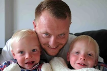 Kỳ lạ cặp sinh đôi có cơ quan nội tạng nằm đối lập nhau