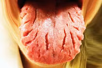 Những căn bệnh rùng rợn ở lưỡi khiến bạn khóc thét