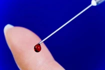 Thiết bị thần kỳ phát hiện ung thư trong vài phút