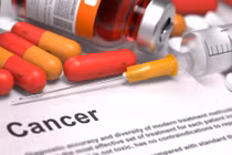 Top bệnh ung thư bạn dễ mắc khi về già