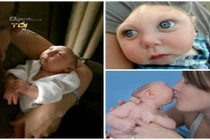 Bí mật giờ mới tiết lộ về bé trai có nửa hộp sọ