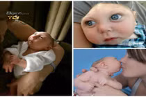 Bí mật giờ mới tiết lộ về bé trai có nửa hộp sọ