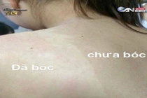 Mê trận lột da tắm trắng siêu tốc giá bèo hút teen Việt