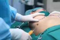 Người phụ nữ nhập viện cấp cứu vì hút mỡ bụng tại thẩm mỹ viện 