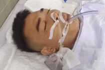 Nhóm giang hồ đất Cảng nổ súng vào nhà dân, bắn trọng thương một người